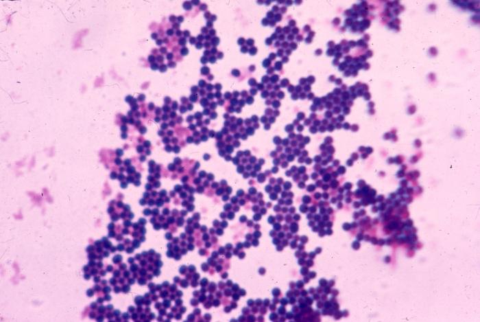 Staphylococcus, co to je?