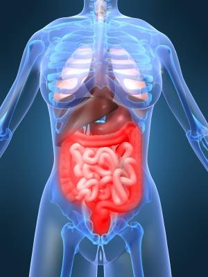 sintomi di diverticolosi intestinale