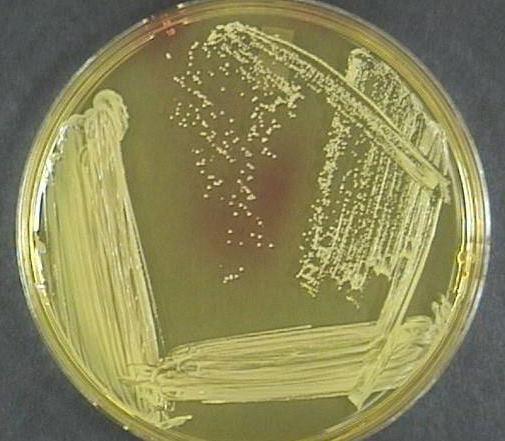 Staphylococcus epidermis v nátěru