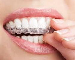реминерализация на зъбите у дома