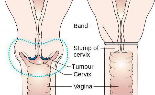 cervikum před menstruací