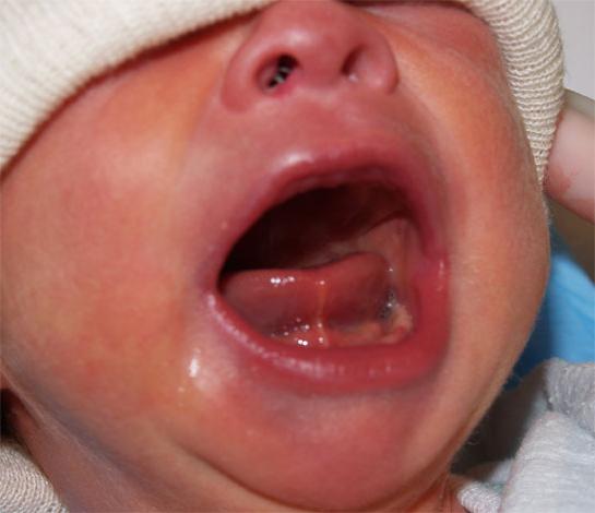gola rossa di un bambino