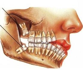 cosa fare quando un dente fa male