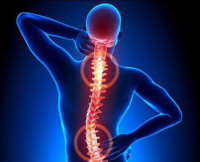 tablete za bolečine v hrbtu z osteohondrozo