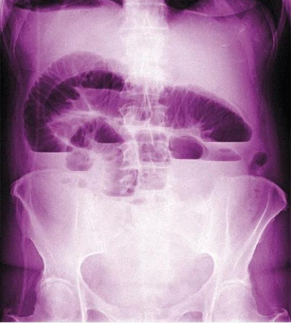 Zdjęcia rentgenowskie