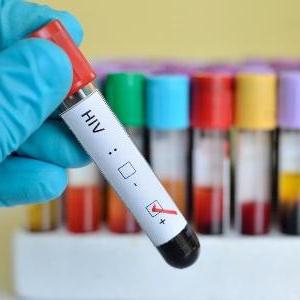 Odejít testu HIV