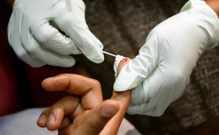 Quali test fanno l'HIV