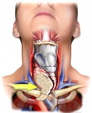 анатомия на щитовидната жлеза