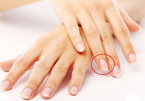 bílé skvrny na nehty prostředního prstu