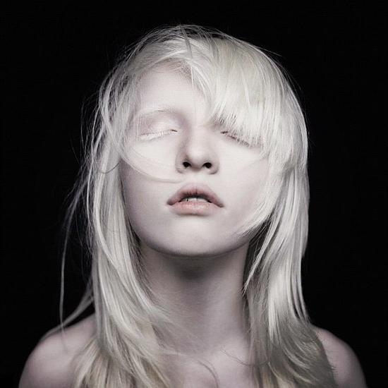 ljudje so albini