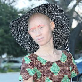 fotky albino lidí