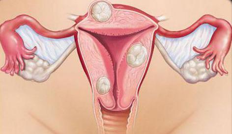 dopo le mestruazioni, basso addome e parte bassa della schiena