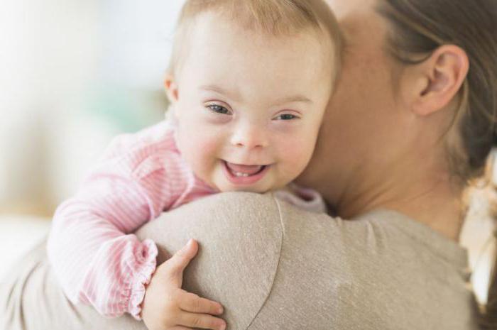 Može li se dijete roditi sa sindromom dolje