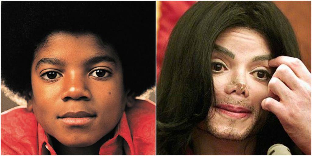 Jak se Jacksonův nos změnil?