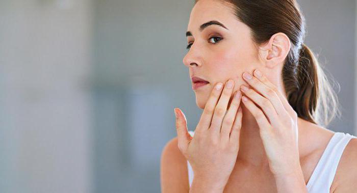 zakaj se akne pojavijo na tvojem obrazu