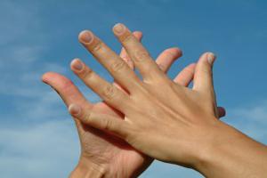 zakaj znoj roke dlani
