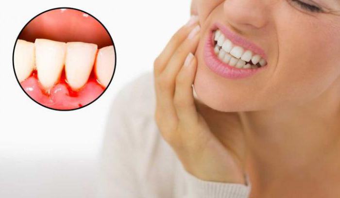 proč bolesti dásní poblíž zubu