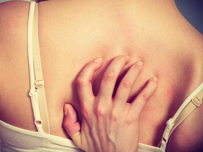 zakaj hrbet povzroča srbečico