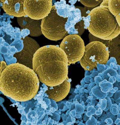 Staphylococcus w nosie