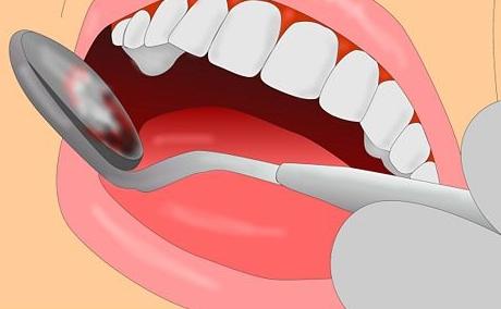 ból zęba pod wypełnieniem
