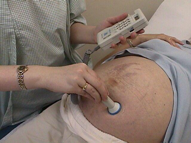 dopplerometrii během těhotenství