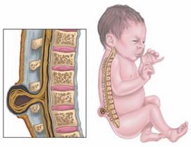 Kwas foliowy w czasie ciąży
