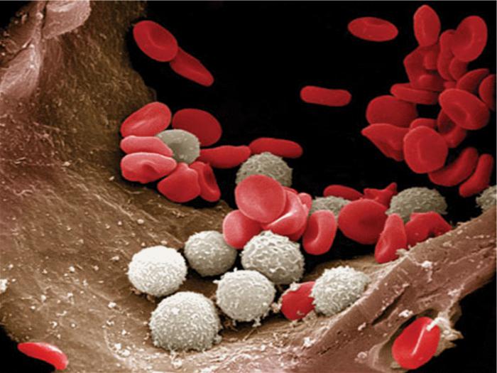 nizak broj bijelih krvnih stanica
