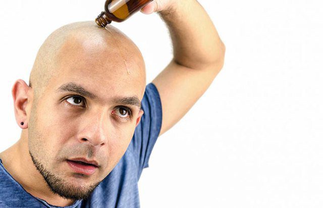 dlaczego człowiek jest przyczyną łysienia