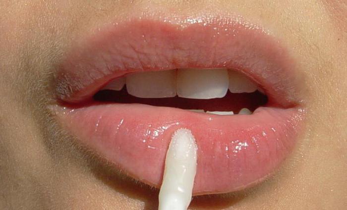 zakaj se vogali ustnic razpokajo in kako se zdravijo