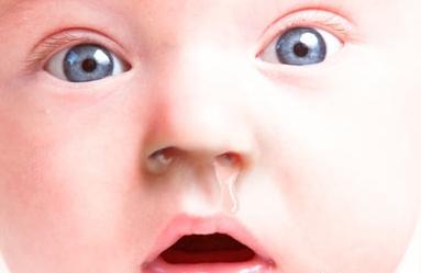 vycpaný nos v novorozenci