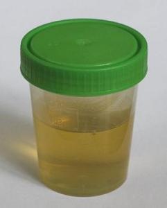 žuti urin
