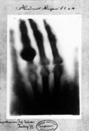 Životopis rendgenskih snimaka Wilhelma
