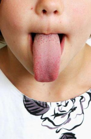бяло жълто на езика на детето