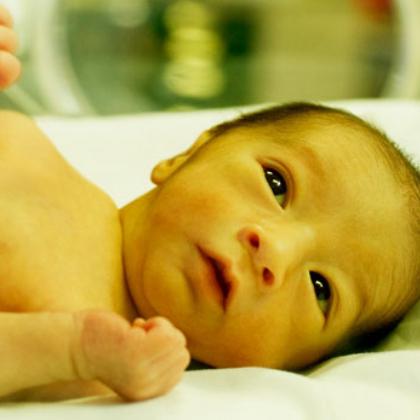 žloutenka u novorozenců normální bilirubin
