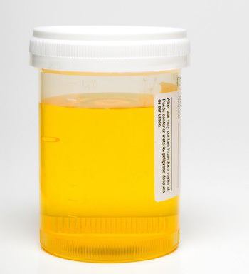 tehnika prikupljanja urina za zimnitsky algoritam