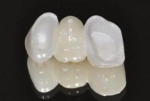 recenzije cirkonijevih zubnih krunica