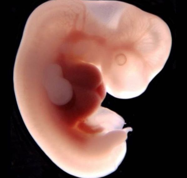 Ljudski embrij